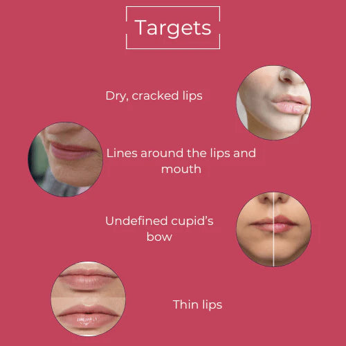 3D Lip Plumping Treatment - enara Wellness