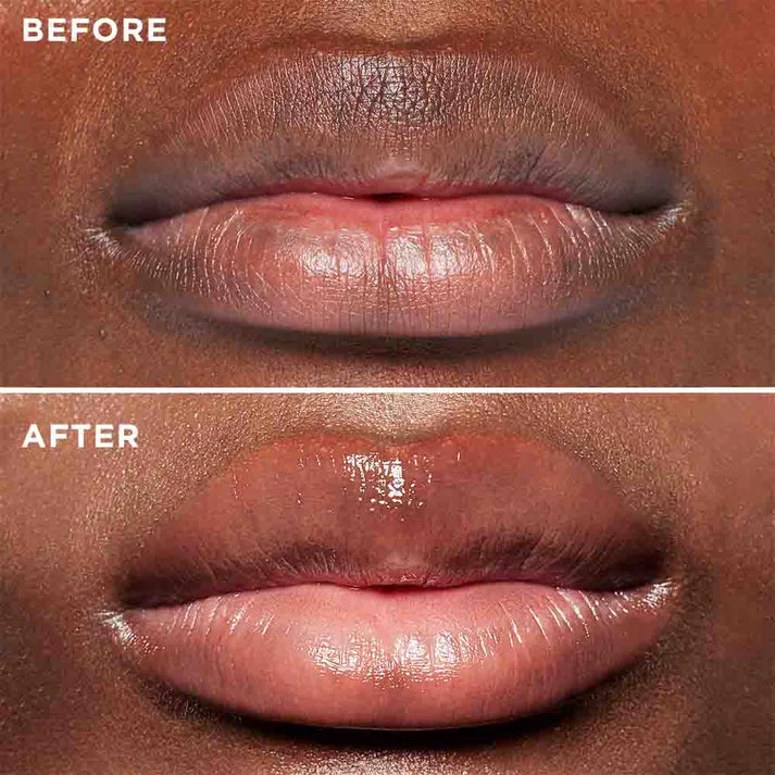 3D Lip Plumping Treatment - enara Wellness