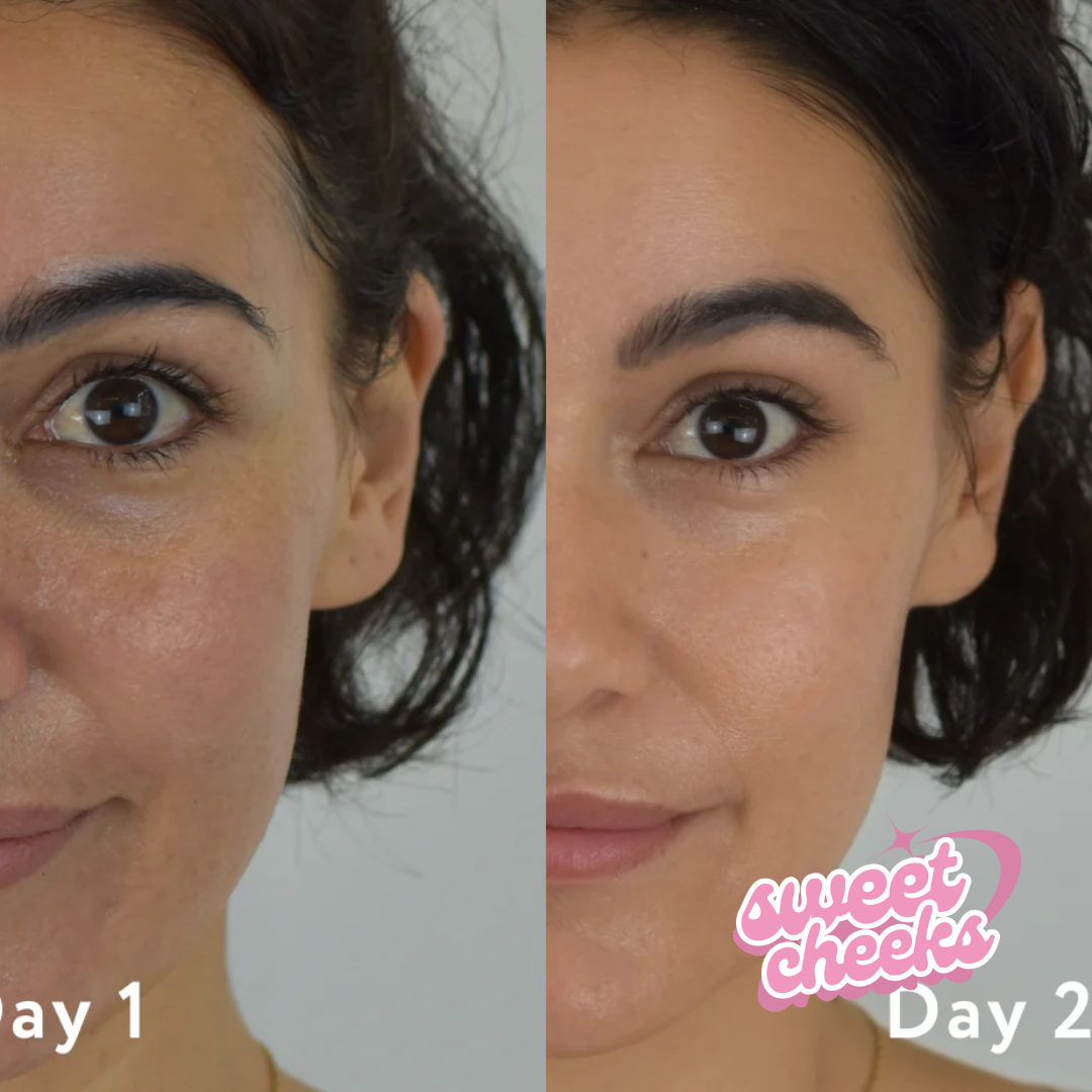 VITAMIN C + HYALURONIC ACID MOISTURISING AND ANTIOXIDANT CREAM - Sweet Cheeks