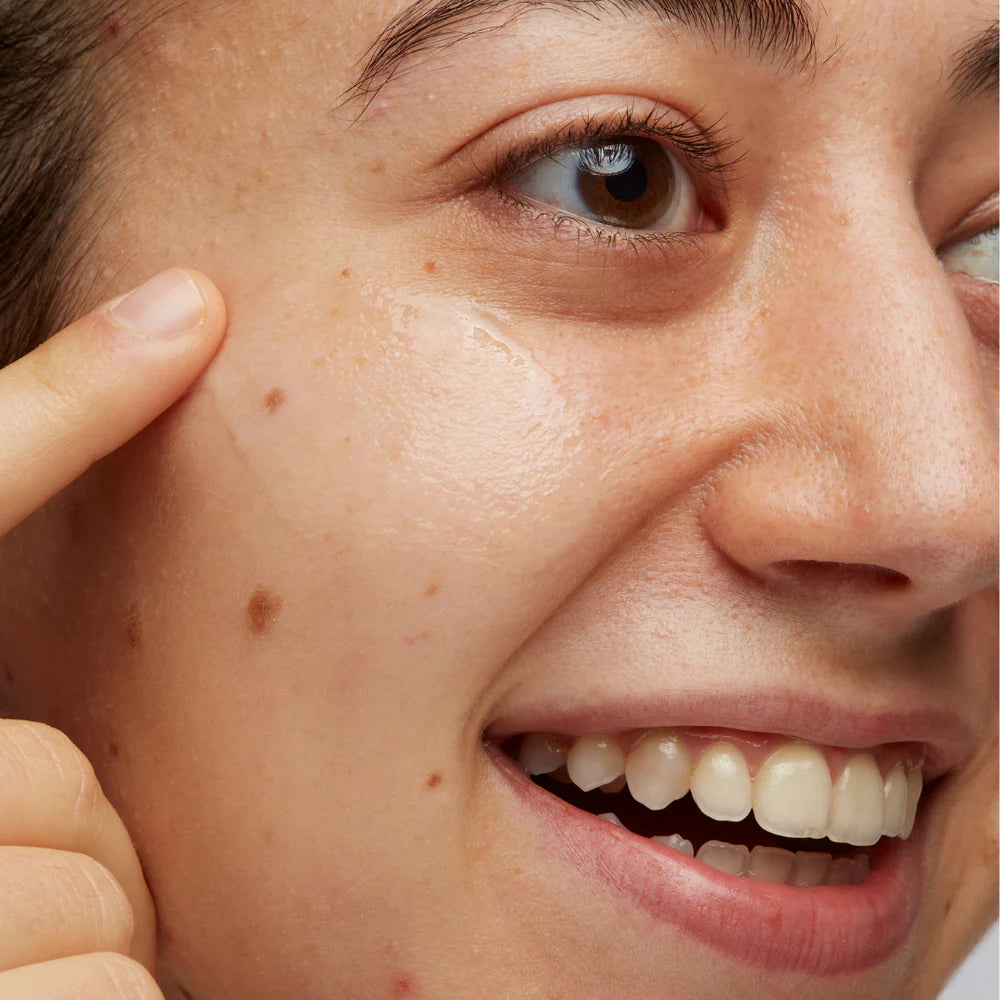 Anti-blemish Boost Serum 15ml - Curated by Ken