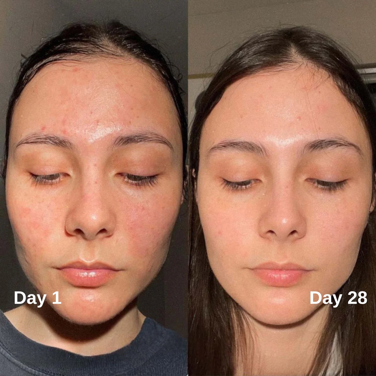 The Perfector Serum - Niacinamide and Kojic Acid - TrueSkinity - 30ML