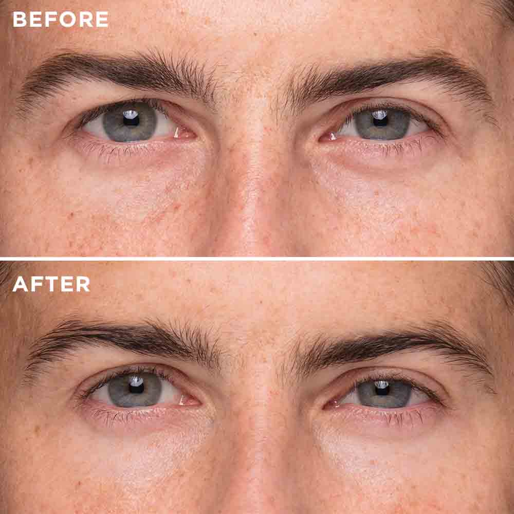 Instant Eye Lift Serum - MIE Skincare