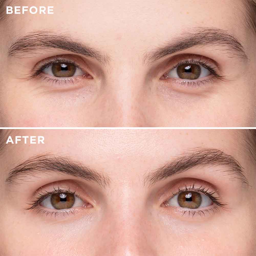 Triple Complex Eye Lift Serum - MIE Skincare